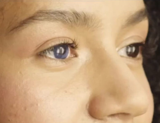 Eye effects: the subtle art of digital eye surgery 4